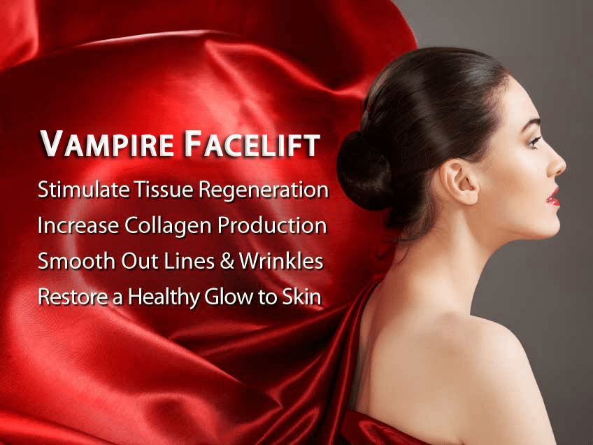 Vampire Facelift® in Anchorage, Alaska