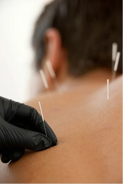Battlefield Acupuncture